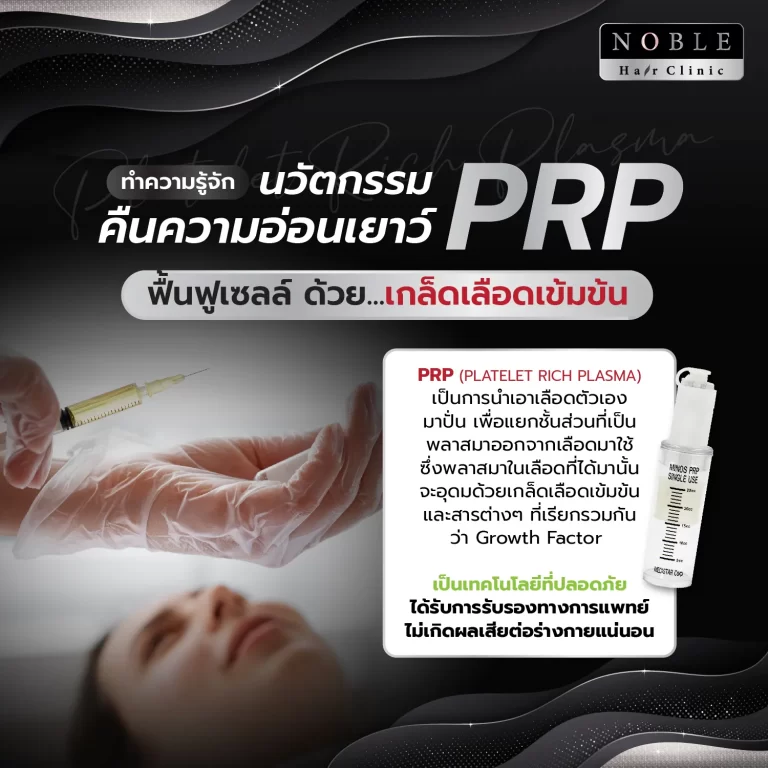 PRP ผม (Platelet Rich Plasma) อินโฟกราฟิก Noble Hair Clinic (1/9)