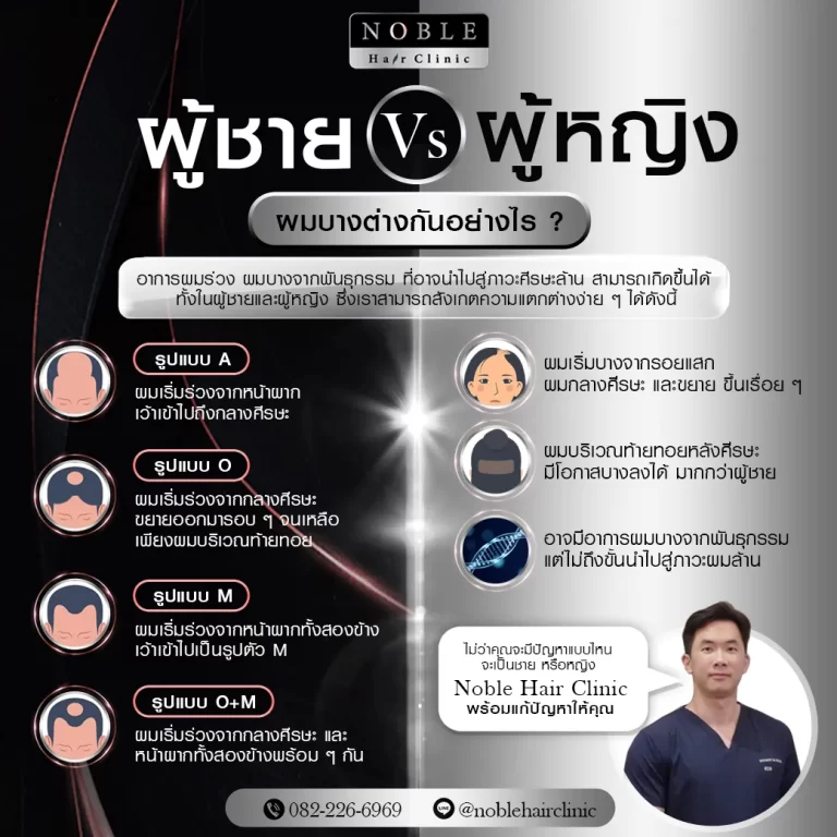 ปลูกผม FUE อินโฟกราฟิก Noble Hair Clinic (1/9)