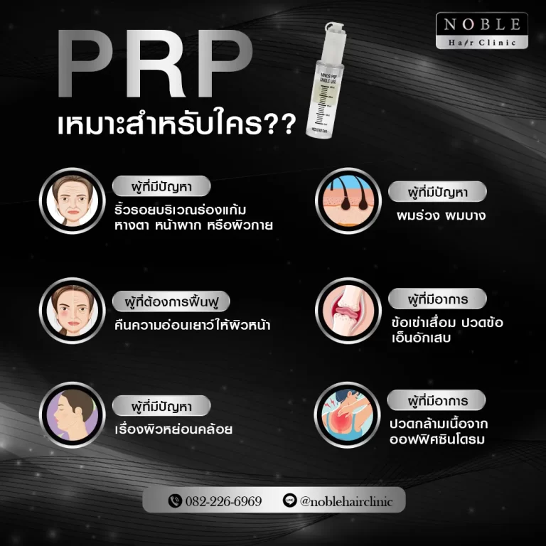 PRP ผม (Platelet Rich Plasma) อินโฟกราฟิก Noble Hair Clinic (2/9)