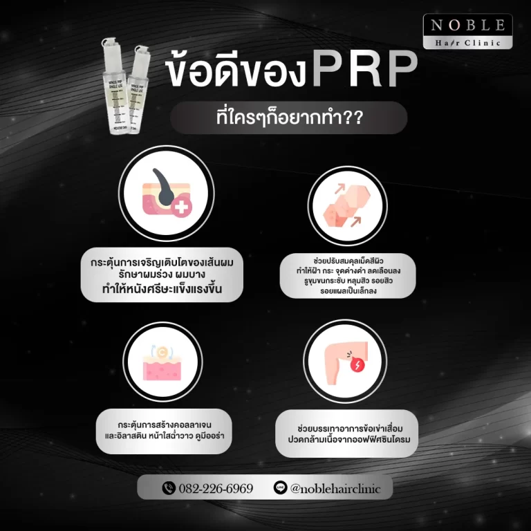 PRP ผม (Platelet Rich Plasma) อินโฟกราฟิก Noble Hair Clinic (3/9)