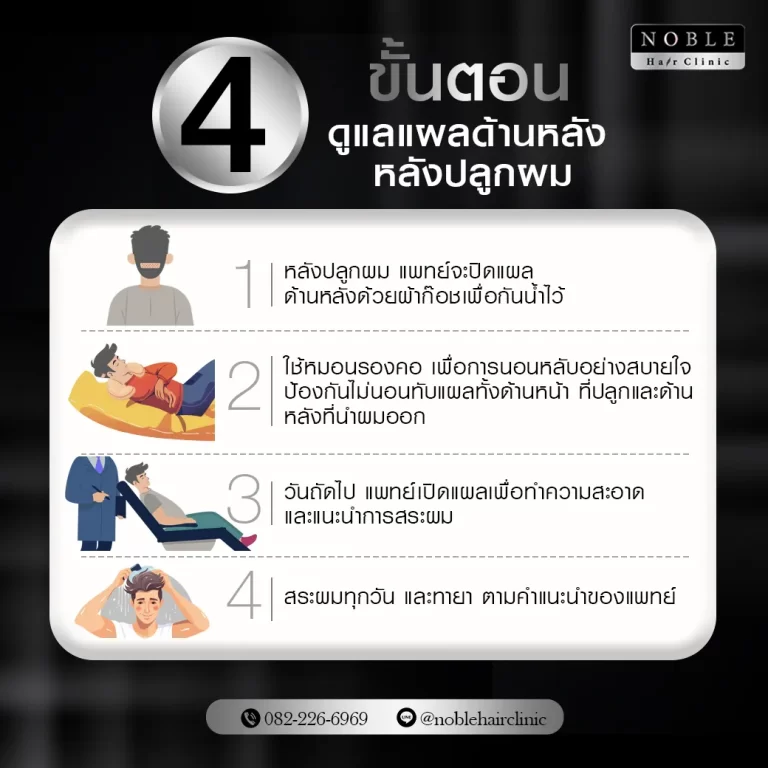 ปลูกผม FUE อินโฟกราฟิก Noble Hair Clinic (6/9)