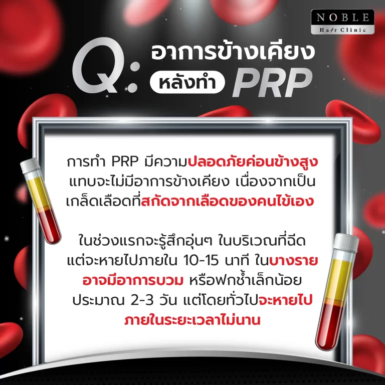 PRP ผม (Platelet Rich Plasma) อินโฟกราฟิก Noble Hair Clinic (7/9)