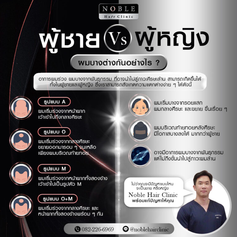 อินโฟกราฟิกอาการผมบางของผู้ชายและผู้หญิงต่างกันอย่างไร
