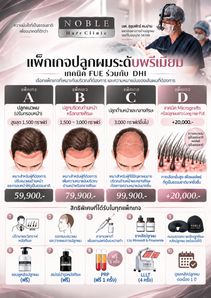 ตารางราคาแพ็กเกจปลูกผม FUE with DHI เริ่มต้น 59,900 บาท