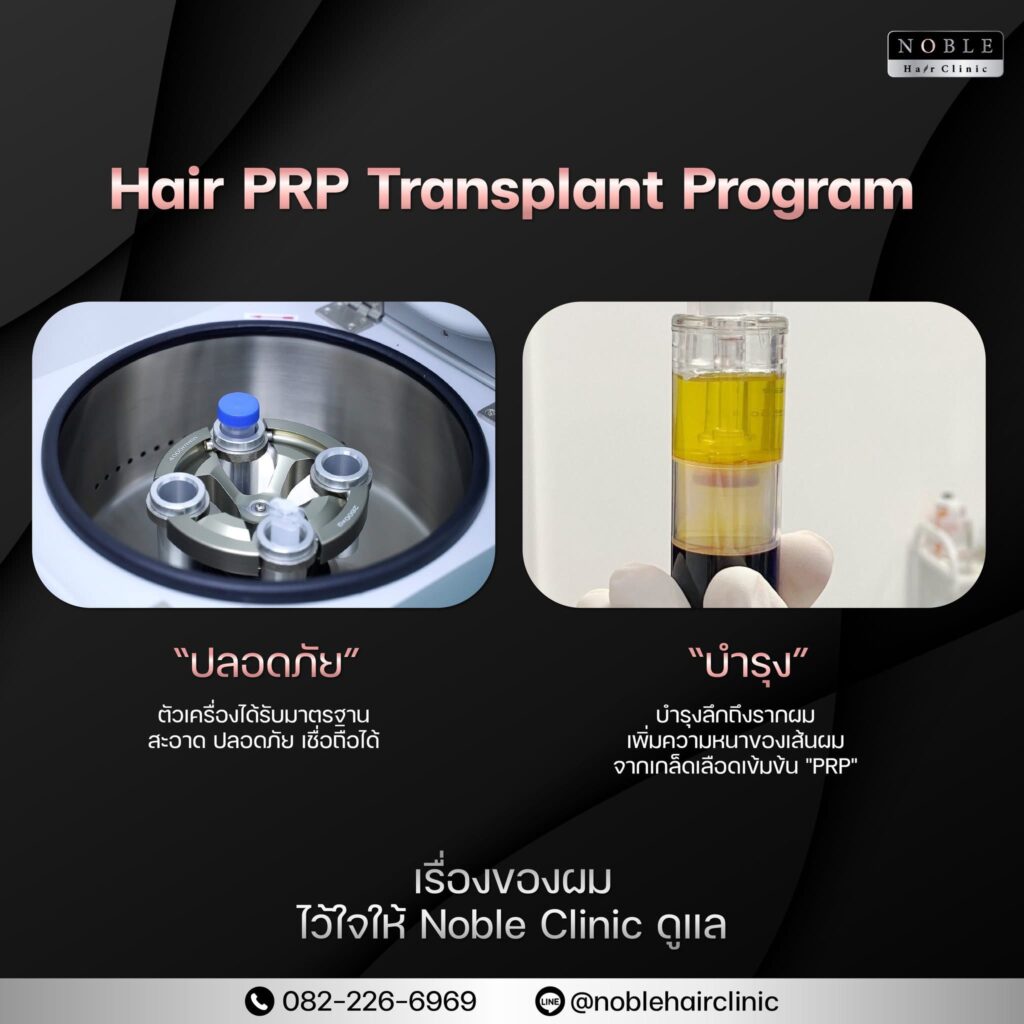 เครื่อง Centrifuge และเกล็ดเลือดเข้มข้น PRP ที่ Noble Hair Clinic