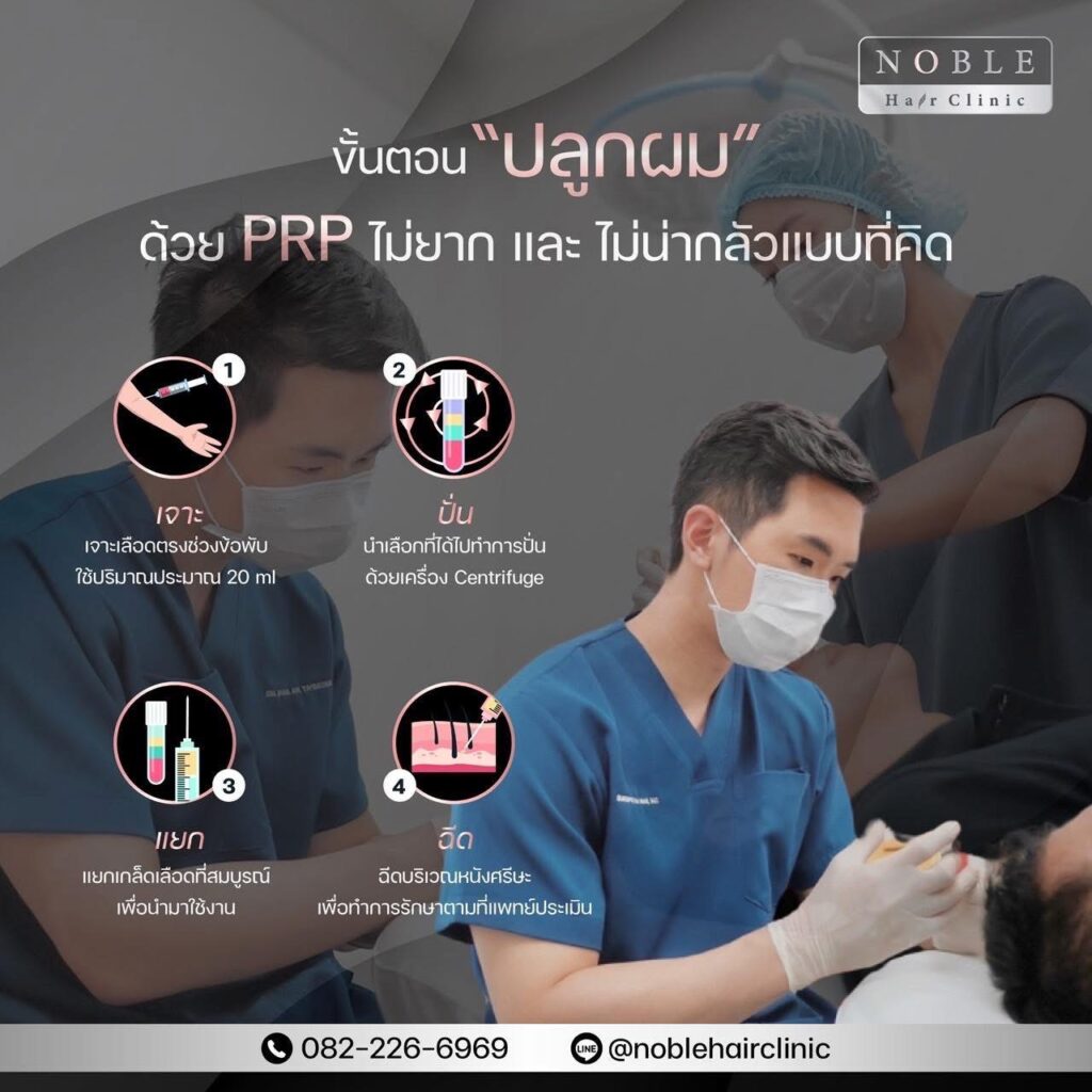 4 ขั้นตอน PRP ผม เจาะเลือด ปั่น แยก ฉีด ที่ Noble Hair Clinic