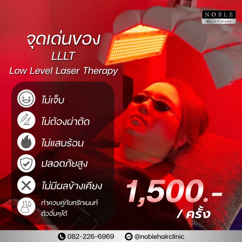 LLLT Low Level Laser Therapy เลเซอร์กระตุ้นรากผม ไม่เจ็บ ไม่ต้องผ่าตัด Noble Hair Clinic