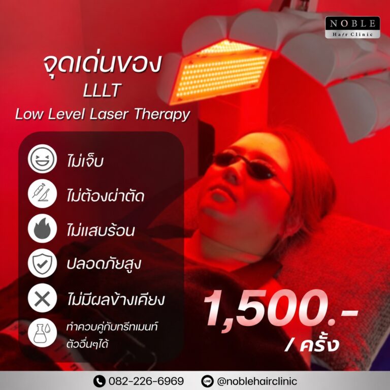 LLLT Low Level Laser Therapy เลเซอร์กระตุ้นรากผม ไม่เจ็บ ไม่ต้องผ่าตัด Noble Hair Clinic
