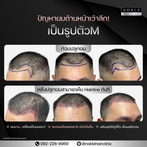 20250506_205656_IMG_3433