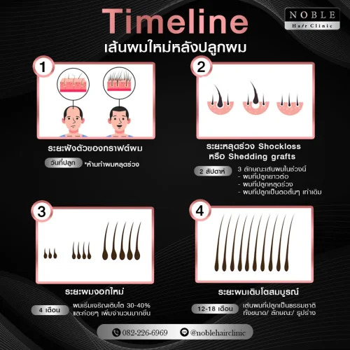 Banner-Noble-hair-012-02_result