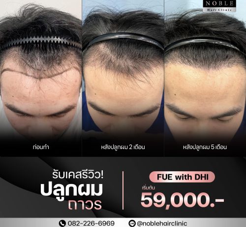 Noble Hair Clinic